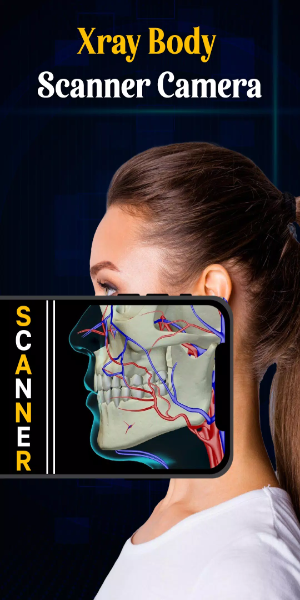 X Ray Mobile v.2.0 Скриншот 1